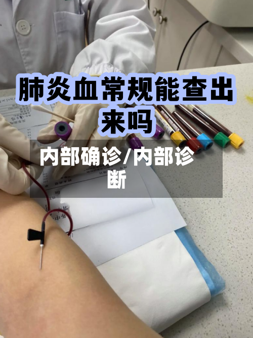 内部确诊/内部诊断