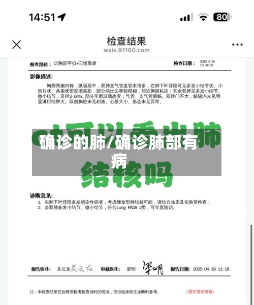 确诊的肺/确诊肺部有病