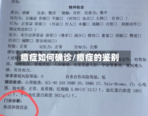 癔症如何确诊/癔症的鉴别