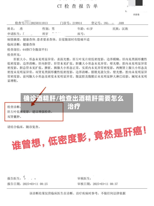 确诊酒精肝/检查出酒精肝需要怎么治疗