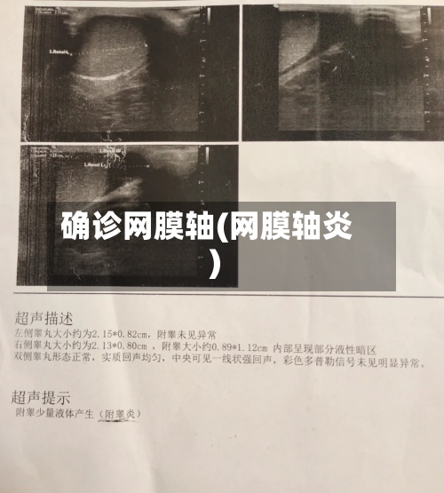 确诊网膜轴(网膜轴炎)