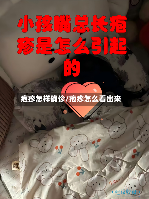 疱疹怎样确诊/疱疹怎么看出来