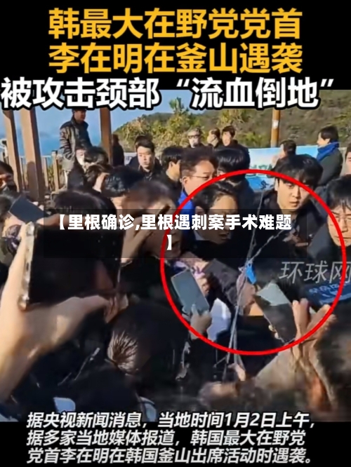 【里根确诊,里根遇刺案手术难题】