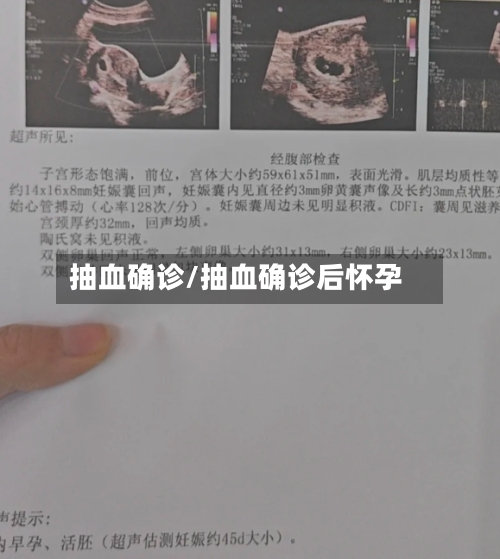 抽血确诊/抽血确诊后怀孕