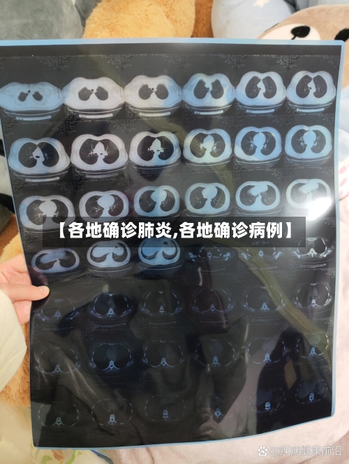 【各地确诊肺炎,各地确诊病例】
