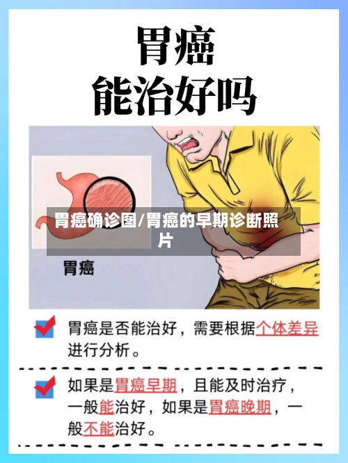 胃癌确诊图/胃癌的早期诊断照片