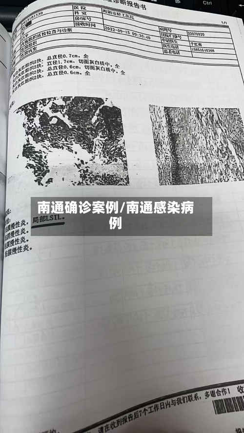 南通确诊案例/南通感染病例