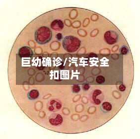 巨幼确诊/汽车安全扣图片